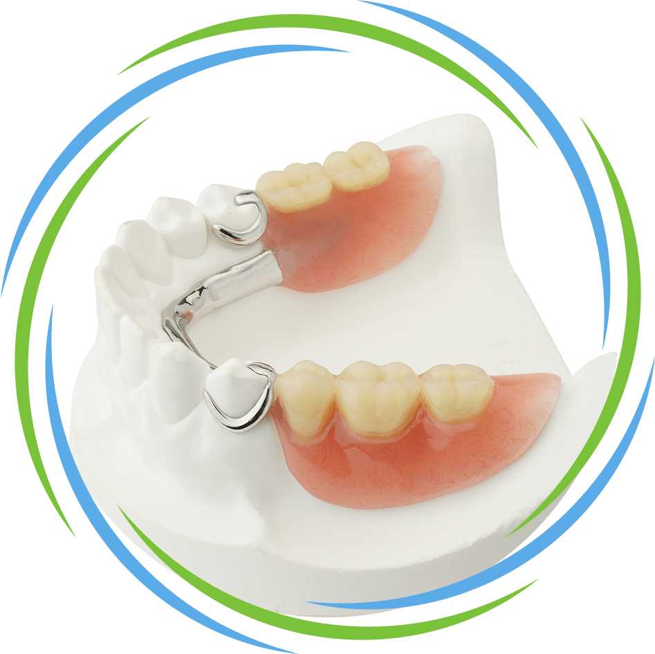 partial dentures