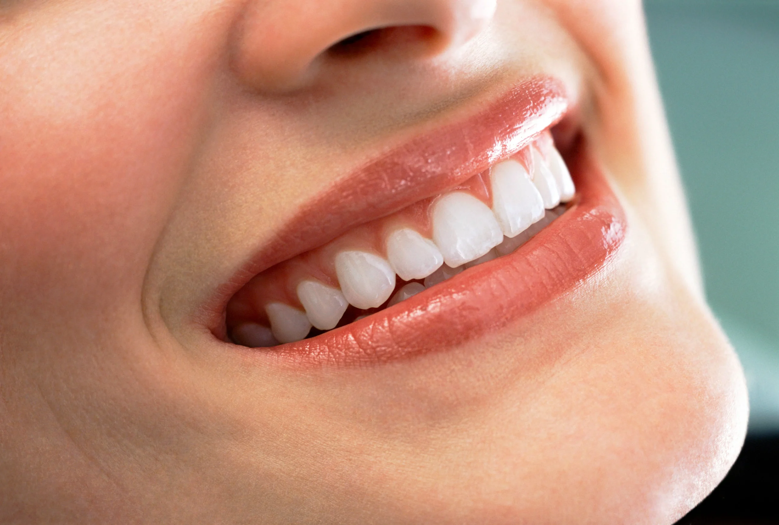 How Long Do Porcelain Veneers Last