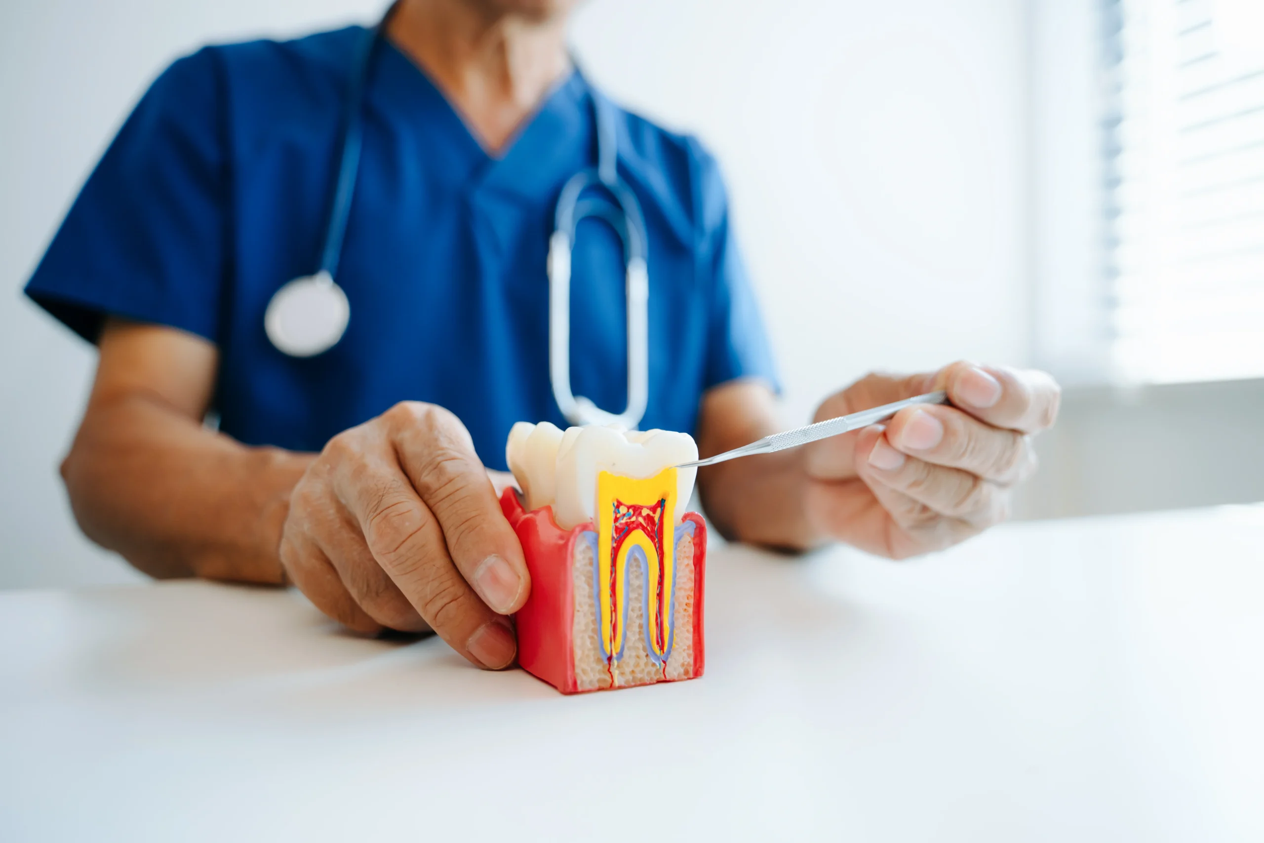 Gum Disease Stages